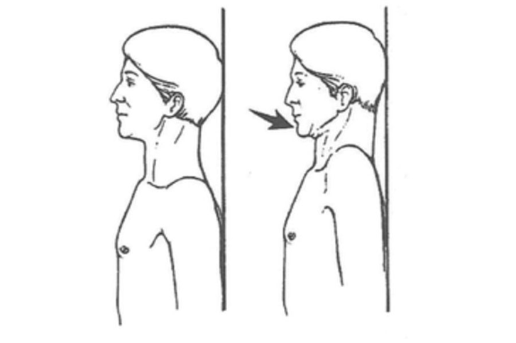 Cervical Retraction/Chin Tuck